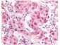 Anti-E2F-1 pS364 (RABBIT) Antibody