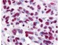 Anti-GLI3 (RABBIT) Antibody