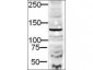 Anti-DIA-2 (RABBIT) Antibody