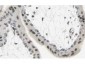 Anti-SMAD3 (RABBIT) Antibody