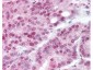 Anti-Heat Shock Protein HSP 90-alpha acetyl specific K294 (RABBIT) Antibody