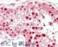 Anti-PIN1 [RABBIT] Antibody