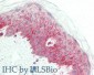 Anti-NCOA3 (RABBIT) Antibody