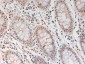 Anti-STAT3 pY705 (RABBIT) Antibody