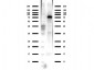 Anti-ACSS2 (RABBIT) Antibody