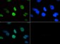 Anti-Histone H3 [Trimethyl Lys18] (RABBIT) Antibody