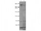 Anti-Huntington (RABBIT) Antibody