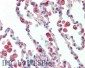Anti-Protein Kinase C delta-Binding Protein (RABBIT) Antibody