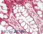 Anti-STIM1 (RABBIT) Antibody