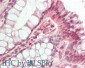 Anti-HDAC5 (RABBIT) Antibody
