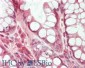Anti-HDAC5 (RABBIT) Antibody