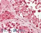 Anti-HDAC10 (RABBIT) Antibody