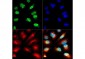 Anti-Histone H3 [ac Lys9/phospho Ser10] (RABBIT) Antibody