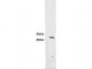 Anti-RFP (CHICKEN) Antibody
