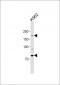 Anti-ALK antibody