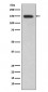 DSG1 Antibody
