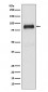 SATB2 Antibody