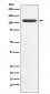 HIP1 Antibody