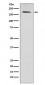 ErbB2 (HER2) Antibody