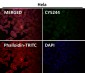 Notch1 Antibody 