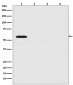 Firefly Luciferase Antibody
