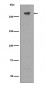 M6PR/IGF2R Antibody