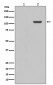 Phospho-FAK (Y397) Antibody