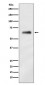 hnRNP K Antibody