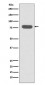Radixin Antibody