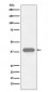 Troponin T Antibody
