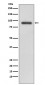 RALBP1 Antibody