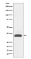 MAD2L1BP Antibody