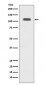 GART Antibody