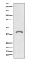 AGTR2 Antibody