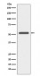 Cytokeratin 6 Antibody