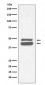 Cytokeratin 18 Antibody