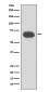 Cytokeratin 1 Antibody