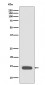 Histone H2B (acetyl K20) Antibody