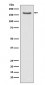 FANCD2 Antibody