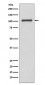 INPP4B Antibody