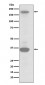RON Antibody