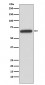 HNF1 beta Antibody