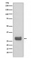 14-3-3 epsilon Antibody
