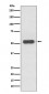 Estrogen Receptor beta Antibody