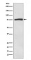 ACSS2 Antibody