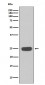 Interferon gamma Antibody