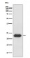 Lipocalin-2 Antibody
