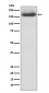 NEFM Antibody