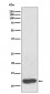 Serum Amyloid A Antibody