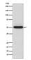alpha Sarcoglycan Antibody
